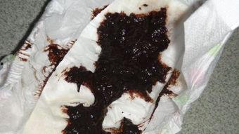 吃瓜拉黑屎,揭秘网络谣言背后的真相