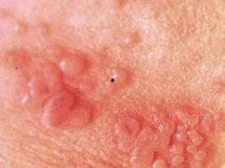 皮炎子吃瓜,揭秘娱乐圈的甜蜜瓜田